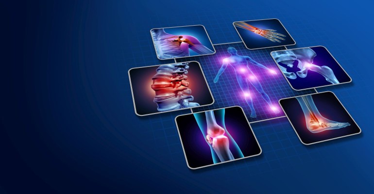 Joint health support ingredients - Primo Trading Company Limited